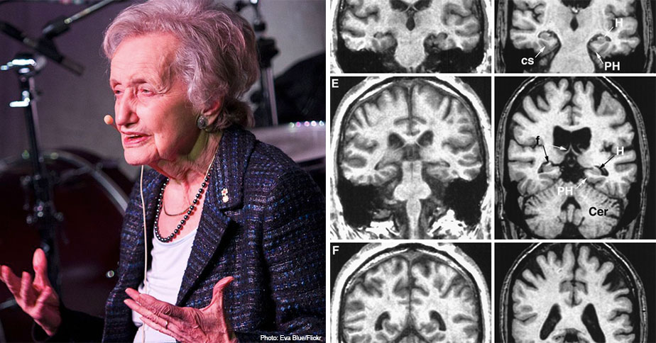 At 104 Years Old, Neuroscientist Brenda Milner Is Still Unlocking The Mysteries of the Brain | A Mighty Girl